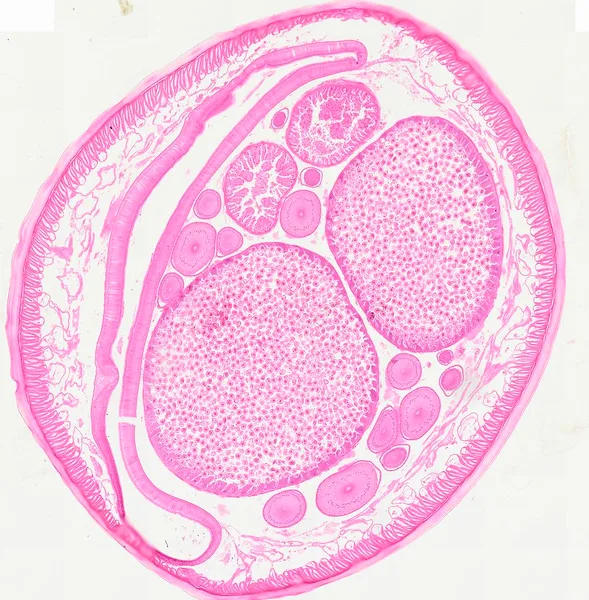 Ascaris Female (Cross Section) under the microscope