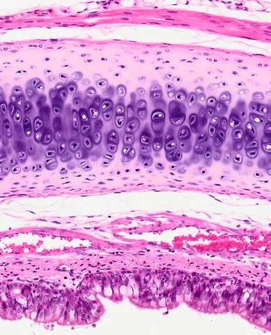 Hyaline Cartilage (Trachea Section) under the microscope