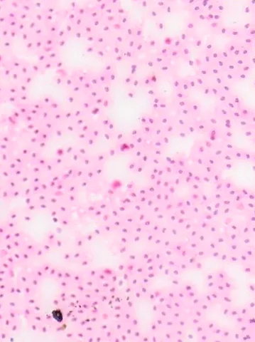 Chicken Blood Smear under the microscope