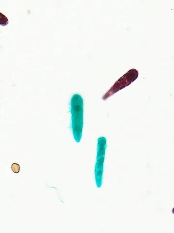Euglena (Whole Mount) under the microscope
