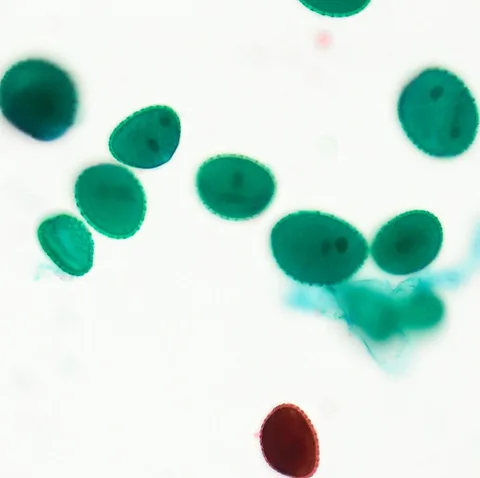 Lily Pollen (Whole Mount) under the microscope
