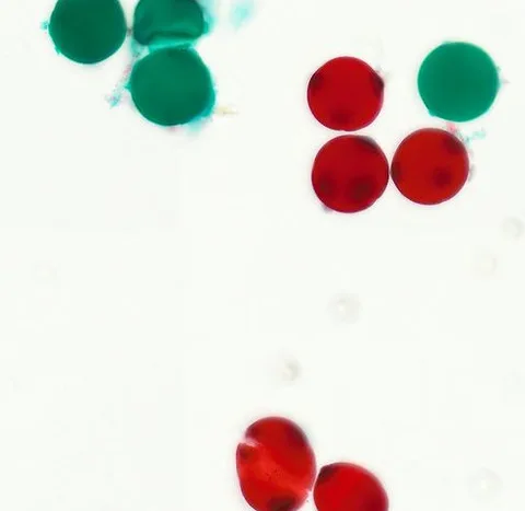 Luffa Pollen (Whole Mount) under the microscope