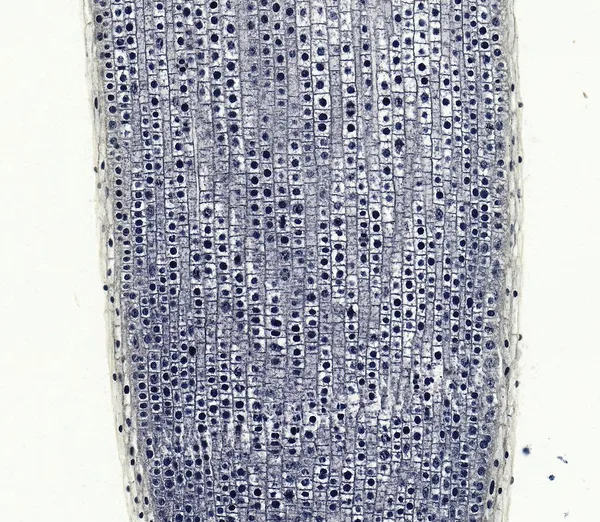 Onion Root Tip Mitosis (Longitudinal Section) under the microscope
