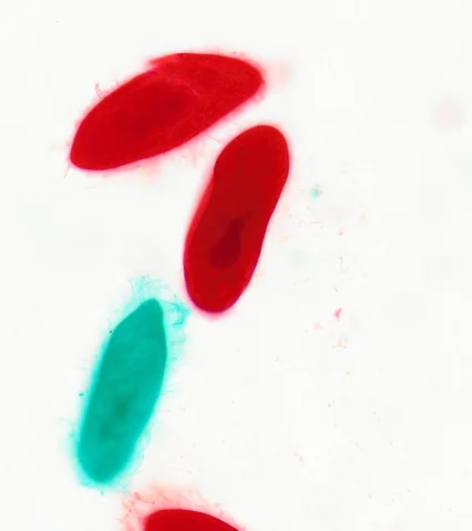 Paramecium (Whole Mount) under the microscope