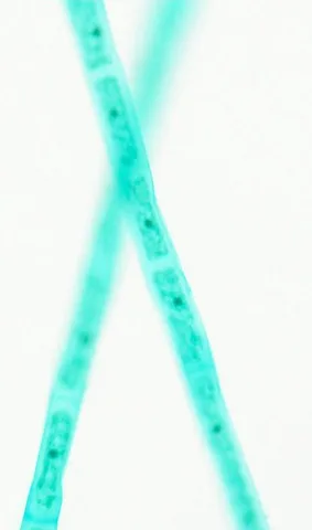 Spirogyra (Whole Mount) under the microscope