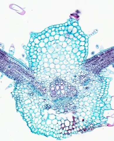 Sunflower Leaf (Cross Section) under the microscope