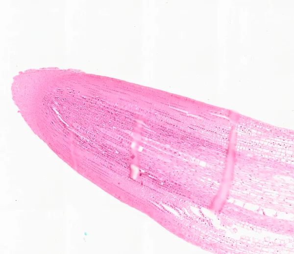 Zea Root Tip (Longitudinal Section) under the microscope