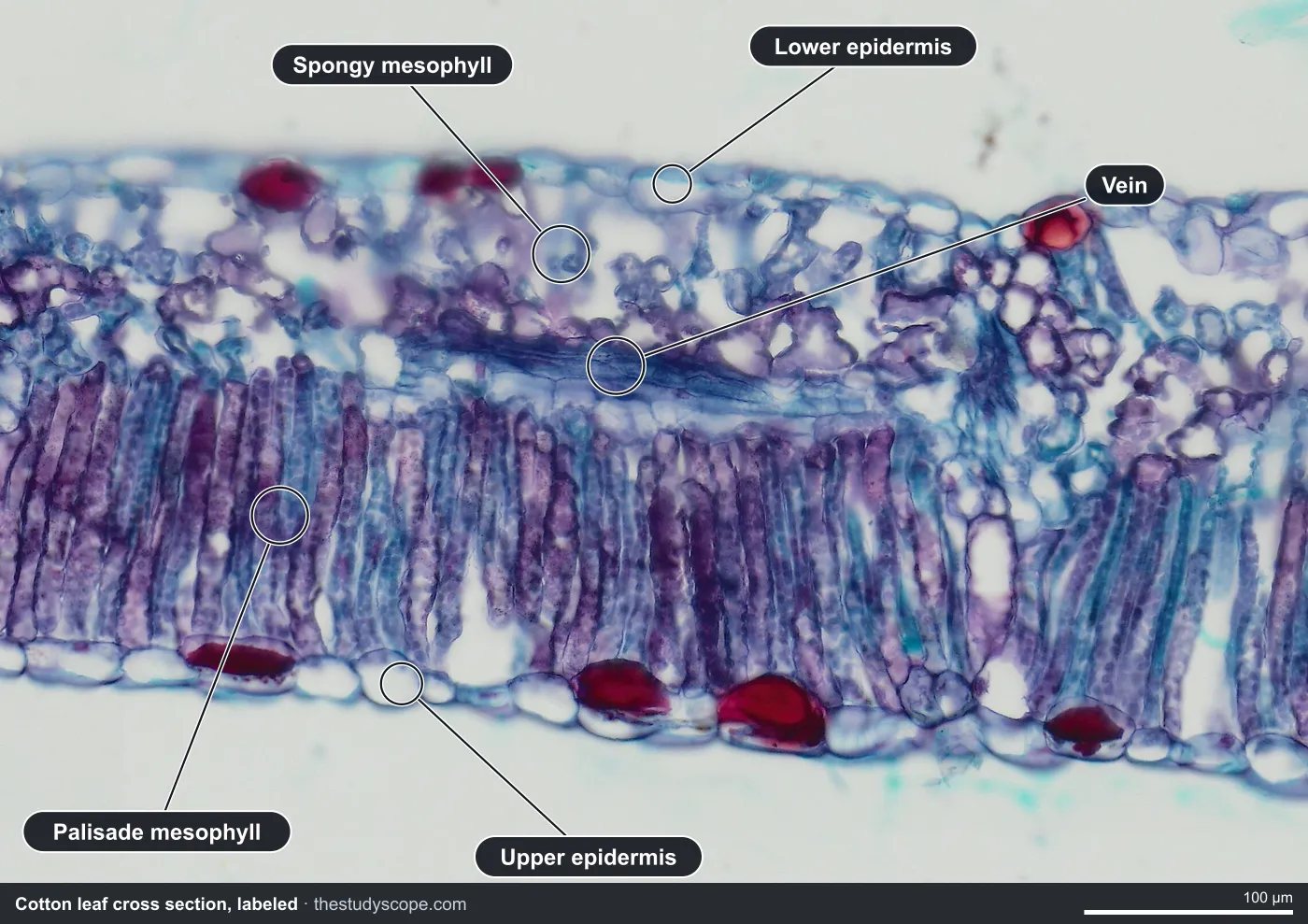 Labeled cotton leaf cross section under the microscope showing the upper and lower epidermis, palisade mesophyll, spongy mesophyll and a vein