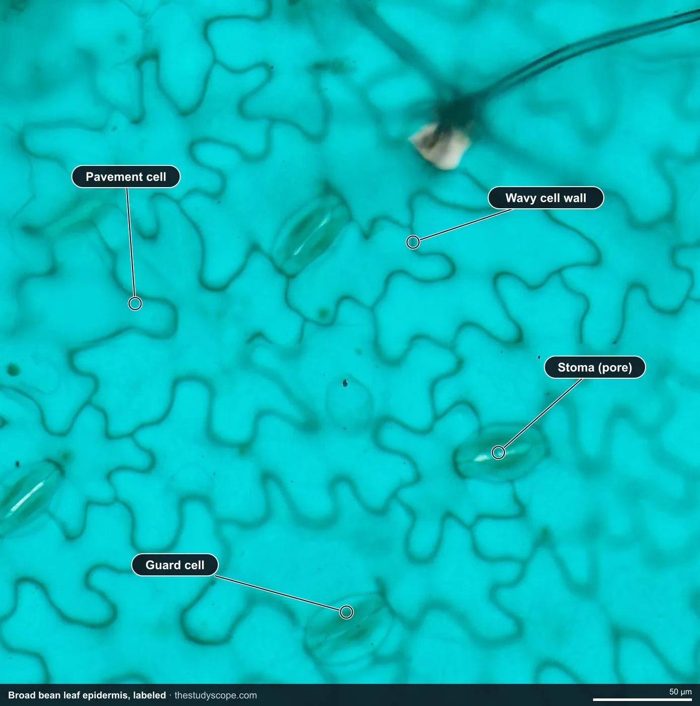 Labeled broad bean leaf epidermis under the microscope showing stomata, guard cells and wavy pavement cells