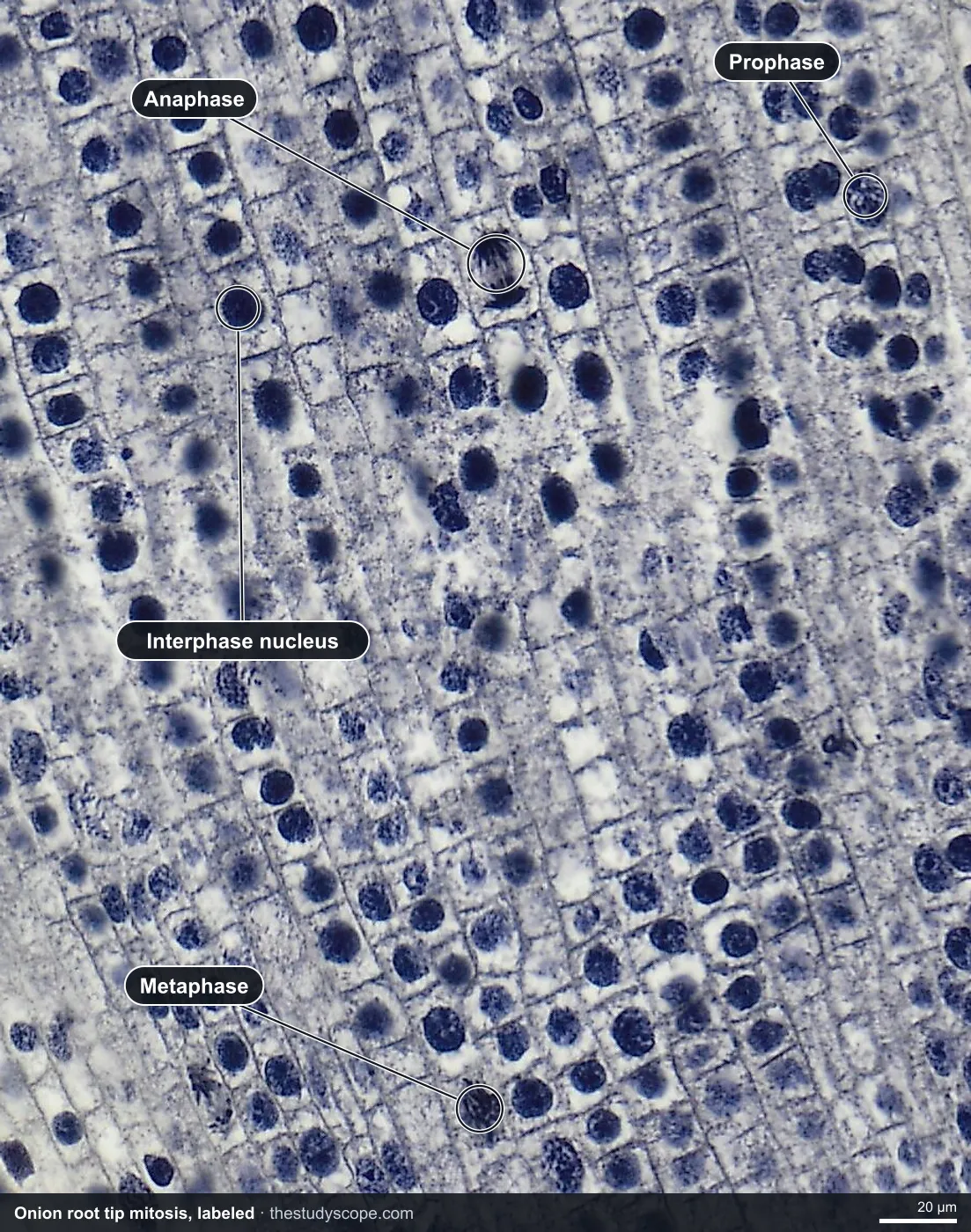 Labeled onion root tip under the microscope showing cells in interphase, prophase, metaphase and anaphase