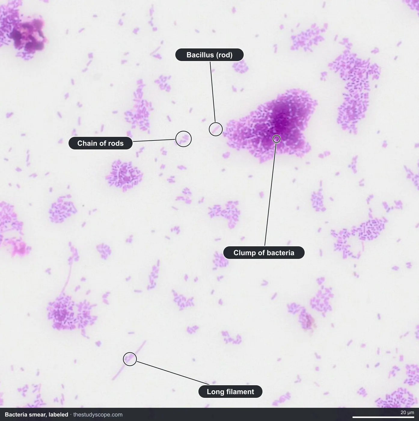 Labeled bacteria smear under the microscope showing rod-shaped bacilli, a chain of rods, a clump and a long filament