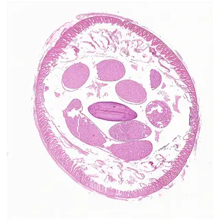 Ascaris Male (Cross Section)