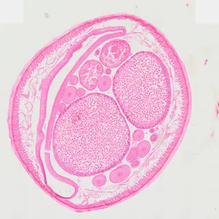 Ascaris Female (Cross Section) under the microscope